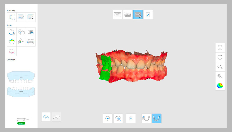 Medit Link Automatic Alignment