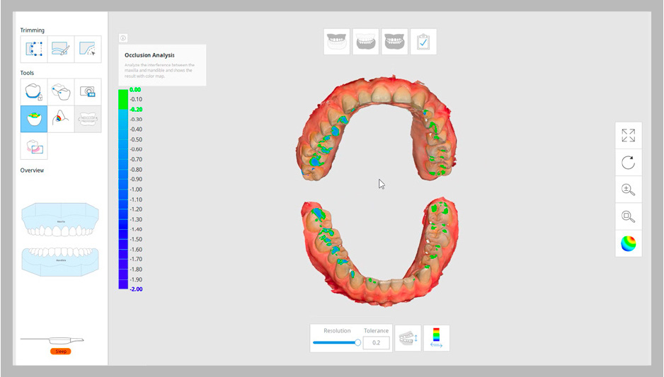 Medit Link Occlusion Analysis