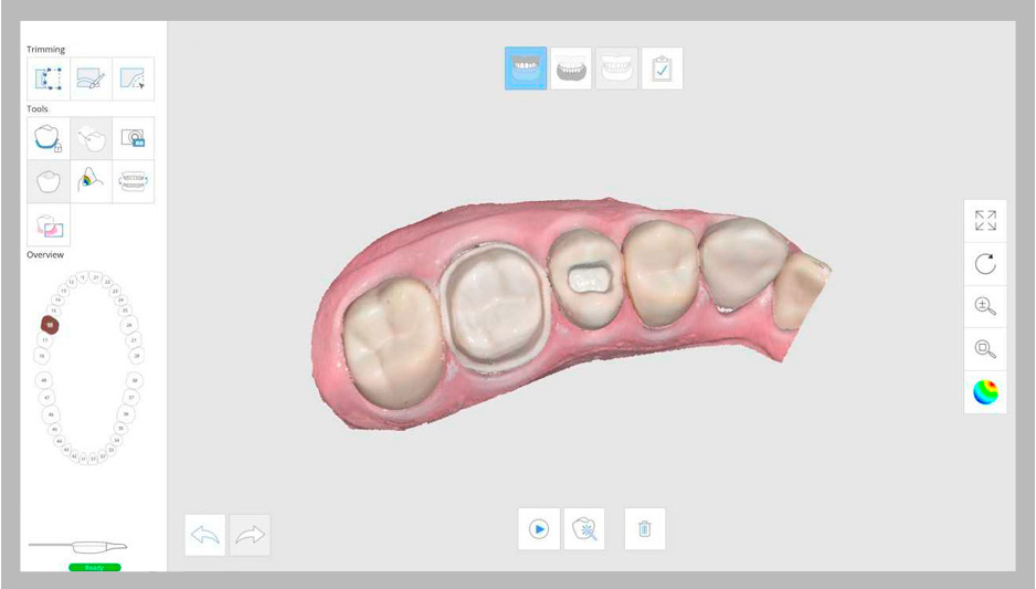 Medit Link User-Friendly User Interface